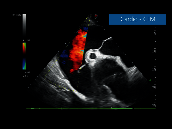 Clinical Image - MyLab™EightVET - Cardio CFM