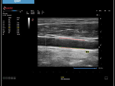 Clinical Image - MyLab<sup>™</sup>X5: QIMT