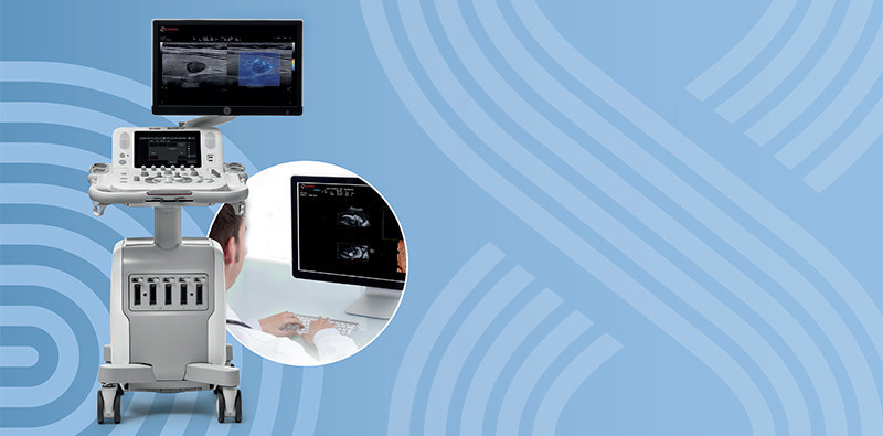 MyLab<sup>™</sup>X8 Platform - Limitless ultrasound imaging