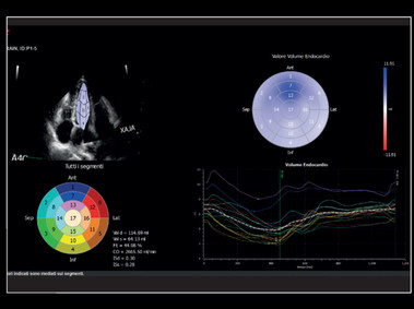 Clinical Image - MyLab<sup>™</sup>X8 Platform - Left Ventricule - Volumetric model of the left function with XStrain4D