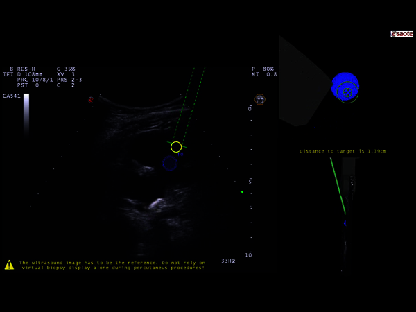 Clinical Image - MyLab™Eight eXP - Kidney Virtual Biopsy
