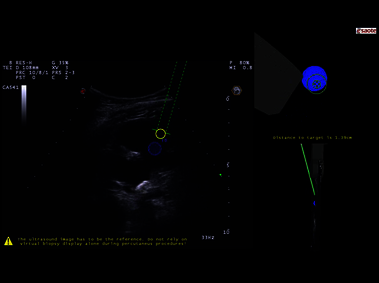Clinical Image - MyLab<sup>™</sup>Eight eXP - Kidney Virtual Biopsy