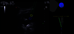 Clinical Image - MyLab™Eight eXP - Kidney Virtual Biopsy