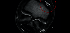 Immagine clinica - O-scan equine: Artropatia del nodello