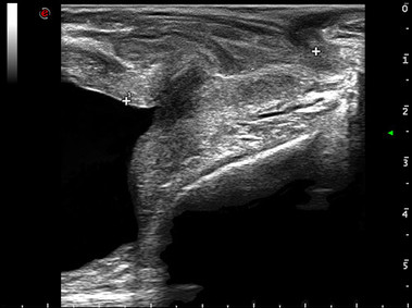 Clinical Image - MyLab<sup>™</sup>Alpha - Prostate Transperineal Imaging