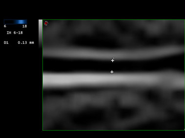 Clinical Image - MyLab<sup>™</sup>Twice - High-Definition Zoom