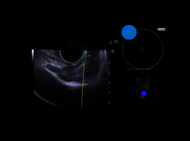 Clinical Image - MyLab<sup>™</sup>Eight eXP - Prostate Virtual Biopsy