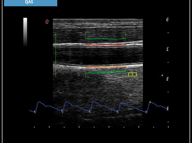 Clinical Image - MyLab<sup>™</sup>X7: QAS