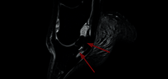 Immagine clinica - O-scan equine: Lesione dei legamenti collaterali dell'articolazione interfalangea distale