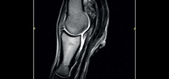 Clinical Image - G-scan equine: Fetlock