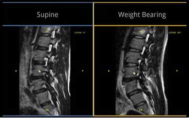 Musculoskeletal MR imaging systems - Esaote