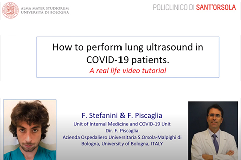 Tutorial on Lung Ultrasound in Covid-19 Patients